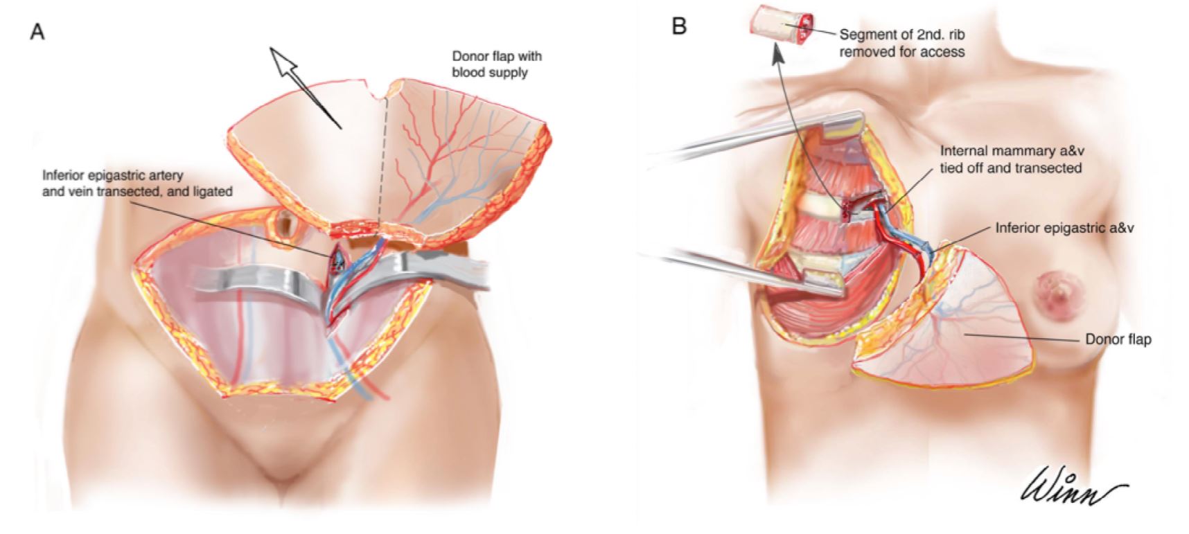 Figure 5.JPG